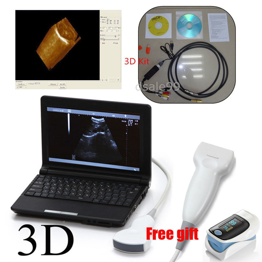 Laptop Ultrasound Scanner Machine Convex Linear 2 Probes Scanning Machine *3D* DIAGNOSTIC ULTRASOUND MACHINES FOR SALE