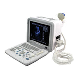 Digital Ultrasound Scanner Machine + Convex &Linear Probes/Transducer 3D Sale 190891528469