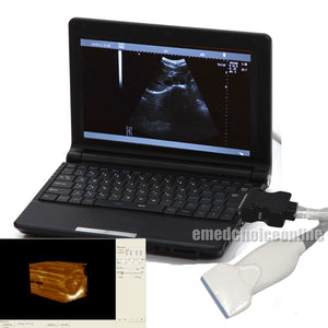 Medical Portable Notebook Laptop Ultrasound Scanner Digital 6.5Mhz Linear Probe 190891866813