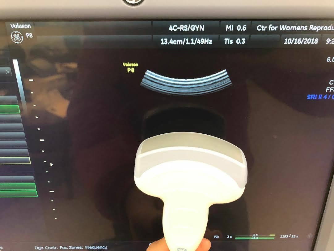 GE 4C-RS Curved Array Ultrasound Probe Transducer for Logiq Voluson Series DIAGNOSTIC ULTRASOUND MACHINES FOR SALE