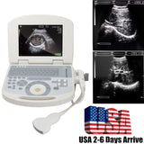 USA! Clear Digital Laptop Medical Ultrasound Scanner Machine Convex Probe 3D 190891422491