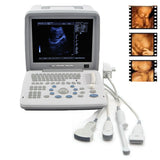 Portable Ultrasound Machine Scanner Convex Linear Endovaginal Micro 4 PROBE+3D