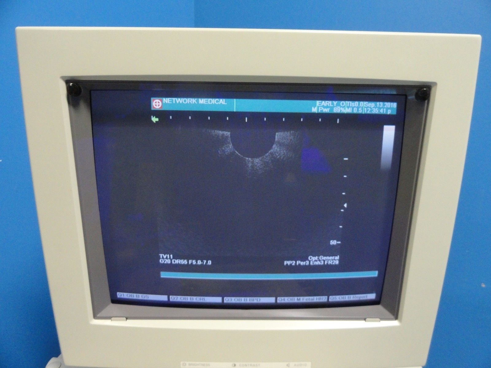 SHIMADZU TV11R-055U Transvaginal Probe For SDU-350/450 SDU-1100/1200/2200(10971) DIAGNOSTIC ULTRASOUND MACHINES FOR SALE