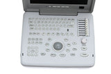 High Image Full Digital Portable Ultrasound Scanner Machine Convex &Linear probe 190891559357