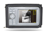CE Factory Medical Ultrasound Scanner Machine Convex Probe Abdominal +Free Gift 190891827272
