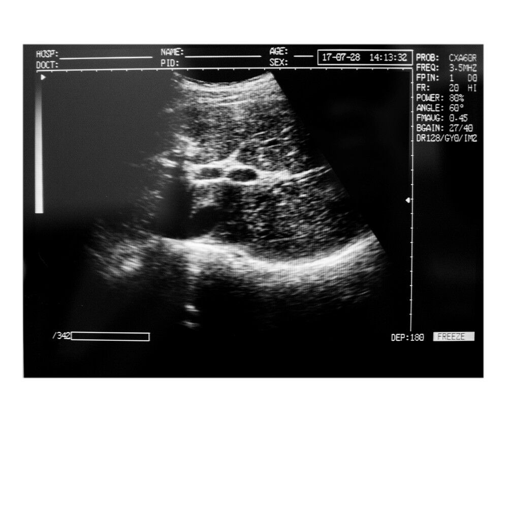 Notebook/Laptop Digital Ultrasound Scanner Convex/Abdominal Probe US STOCK DIAGNOSTIC ULTRASOUND MACHINES FOR SALE