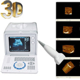 Portable 10'' LCD Digital Ultrasound machine Scanner + 7.5 Mhz Linear Probe+3D