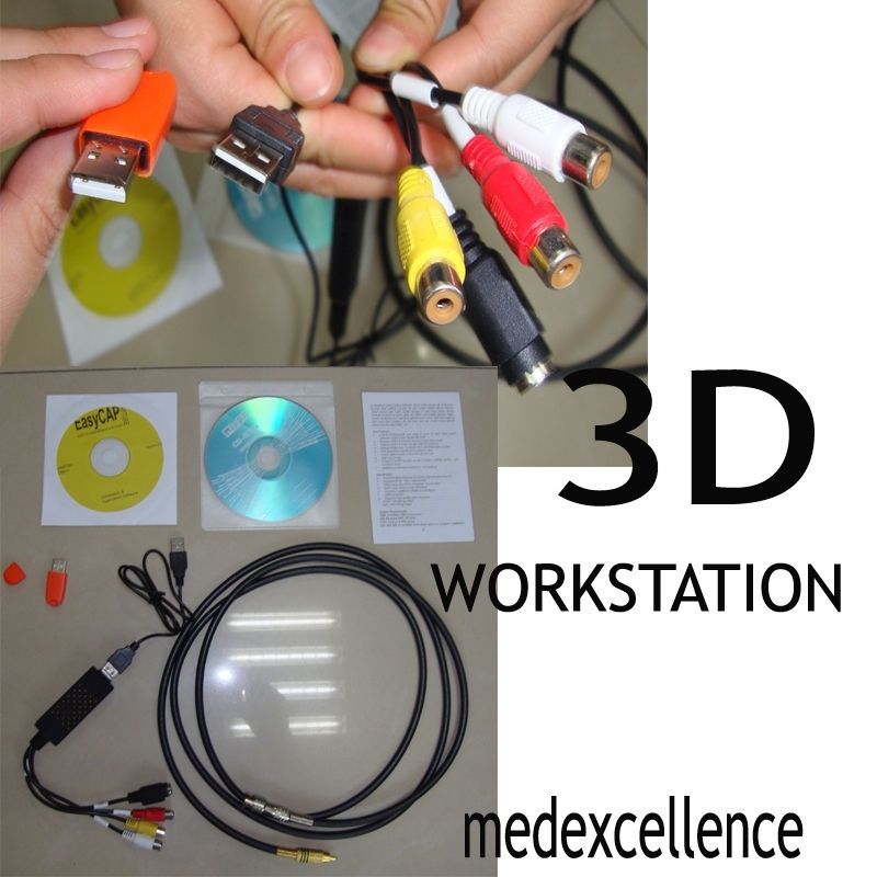 Digital Ultrasound Scanner +3 Probes Transvaginal  Linear Mirco Convex w free 3D DIAGNOSTIC ULTRASOUND MACHINES FOR SALE