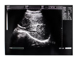 US Fast Ultrasound Machine Ultrasound Scanner Convex probe 3D Software Diagnose 190891045898