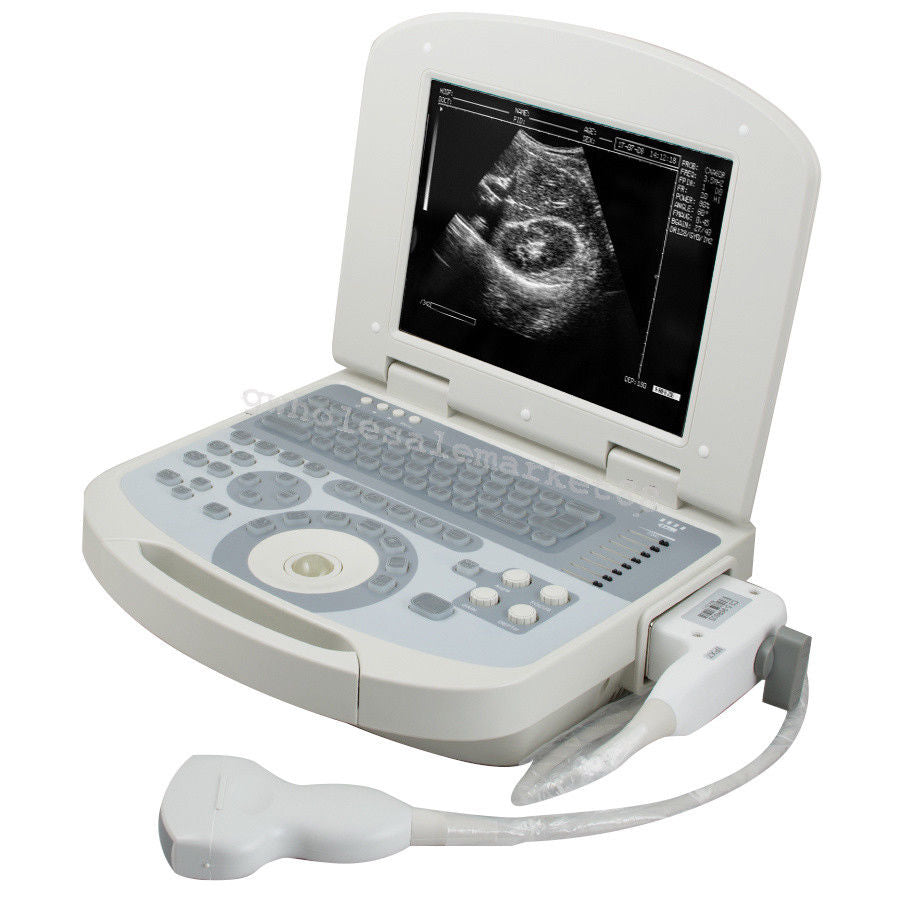 Portable Laptop Ultrasound Machine Scanner Convex Probe 3D Software Image 190891045898 DIAGNOSTIC ULTRASOUND MACHINES FOR SALE