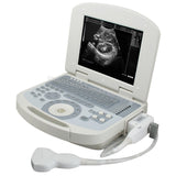 Portable Laptop Ultrasound Machine Scanner Convex Probe 3D Software Image 190891045898