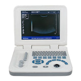 Top 10" SVGA LCD Ultrasound Scanner Notebook + Convex+Micro-convex 2 Probes+Bag 190891772039