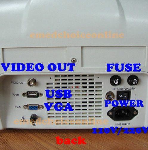 Portable Ultrasound ultrasonic Scanner Machine convex +Transvaginal Probes JXKH! DIAGNOSTIC ULTRASOUND MACHINES FOR SALE