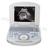 USA High Resolution Laptop Medical Ultrasound Scanner Convex probe +3D Software 190891422491