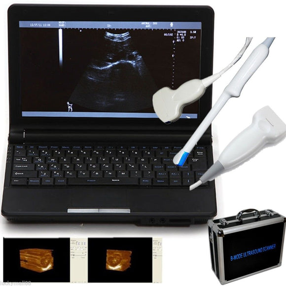 Medical Laptop Machine Ultrasound Scanner Convex/Linear/Transvaginal Probe + 3D 190891044686
