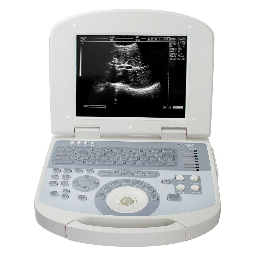 Portable laptop machine Full Digital Ultrasound Ultrasonic scanner Convex probe DIAGNOSTIC ULTRASOUND MACHINES FOR SALE
