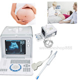 Top 3D Digital Ultrasound Scanner Machine Convex +Transvaginal Probe Pregnancy