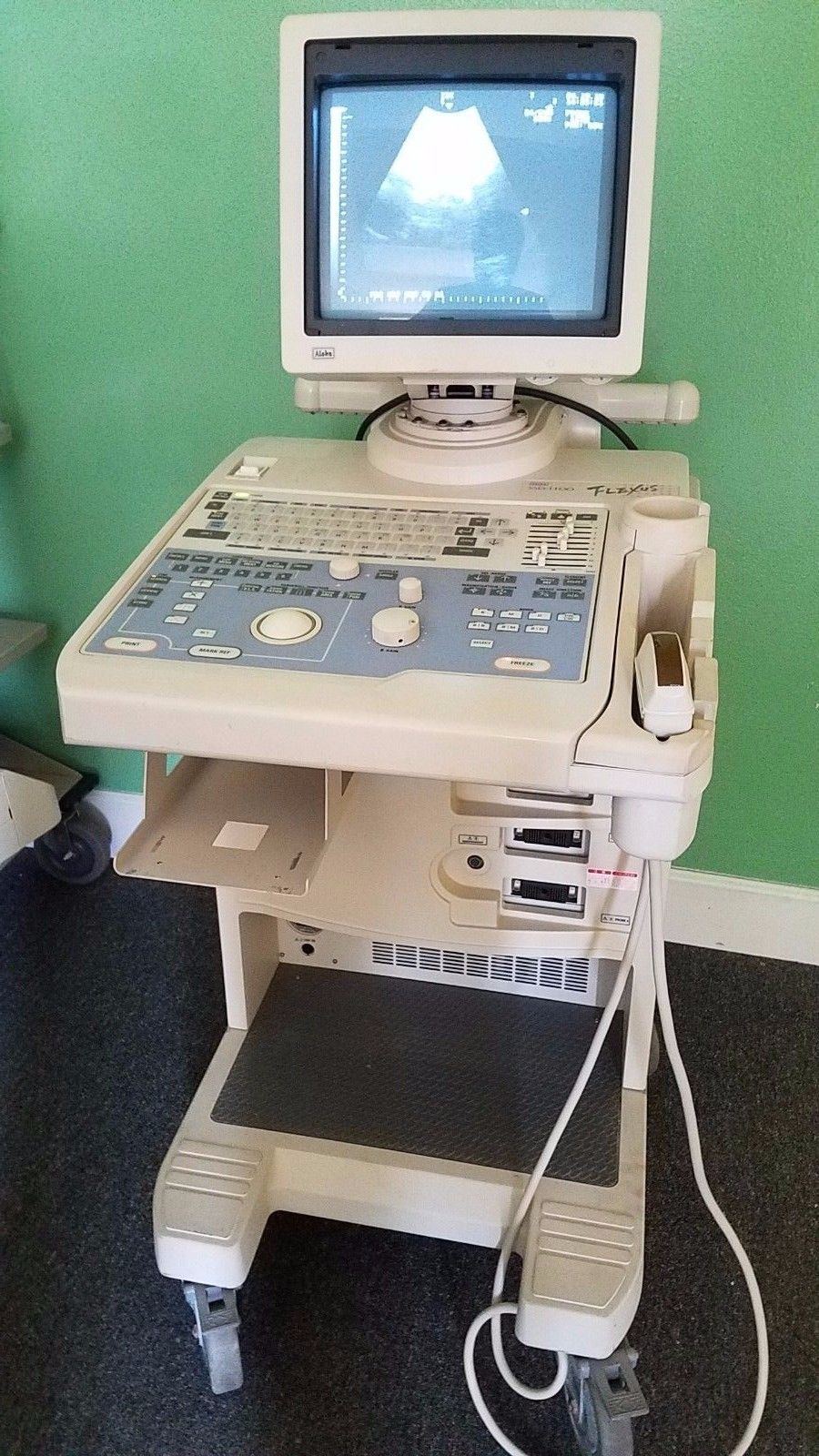 Aloka SSD-1100 Flexus Ultrasound With UST-934N 3.5 Probe DIAGNOSTIC ULTRASOUND MACHINES FOR SALE
