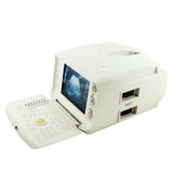 Digital LCD type-B ultrasonic Machine Ultrasound Scanner,Convex,Linear 2 Probes  190891562807