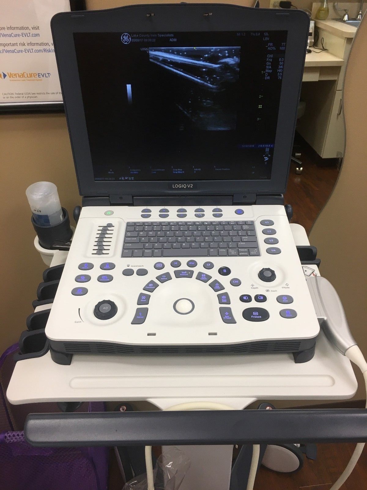 GE Logiq ultrasound on table