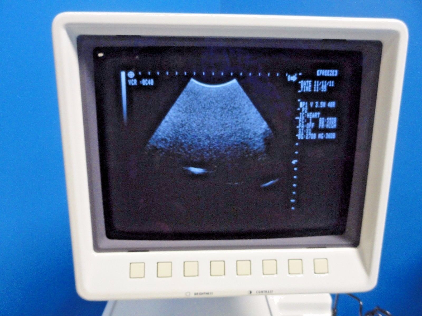 Shimadzu VA40R-035U 3.5 MHz 40mm Convex Probe for SDU-1100 SDU-400 SDU-450~13538 DIAGNOSTIC ULTRASOUND MACHINES FOR SALE