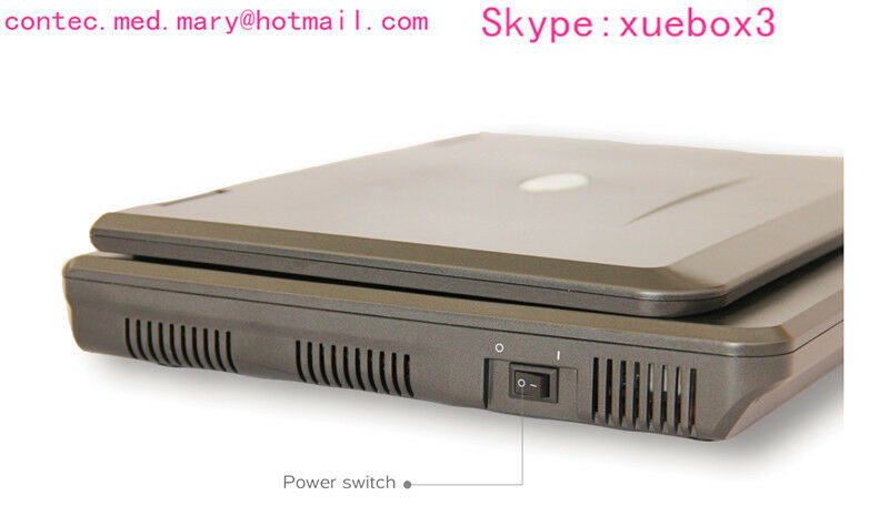Portable laptop machine, Digital Ultrasound scanner, 3.5M Convex probe,US FedEx  658126883672 DIAGNOSTIC ULTRASOUND MACHINES FOR SALE