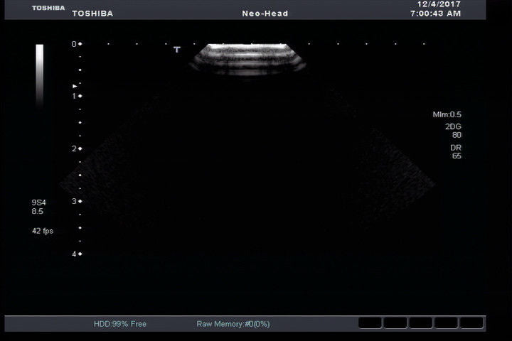 Toshiba PST-65AT Ultrasound Probe DIAGNOSTIC ULTRASOUND MACHINES FOR SALE