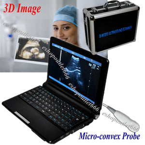 Full Digital Laptop PC Ultrasound Scanner with Mini Micro-convex Probe Carejoy 190891809407