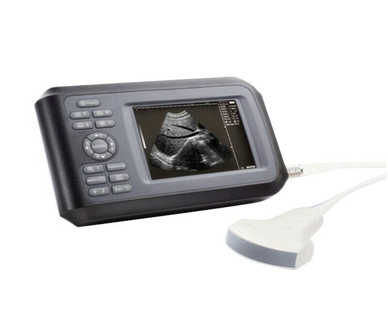 Digital Portable Ultrasound Scanner Machine Convex Probe Human+Case and Belt DIAGNOSTIC ULTRASOUND MACHINES FOR SALE