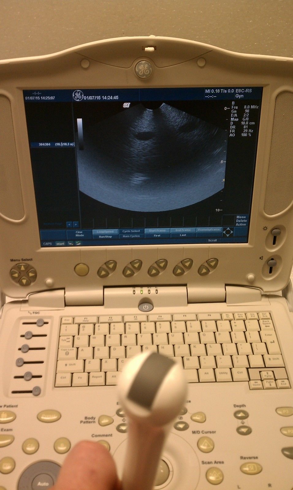 a hand is holding a probe on a ultrasound