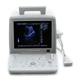 High Image Full Digital Portable Ultrasound Scanner Machine Convex &Linear probe 190891609588