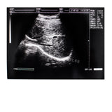 Ultrasound Machine Laptop Ultrasound Scanner Convex probe 3D Software 30% off 190891045898