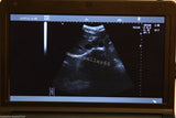 Ultrasound Scanner Monitoring+Convex,Linear,Trans Vaginal,Micro-convex 4 Probes