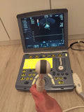 GE Voluson-e portable ultrasound System