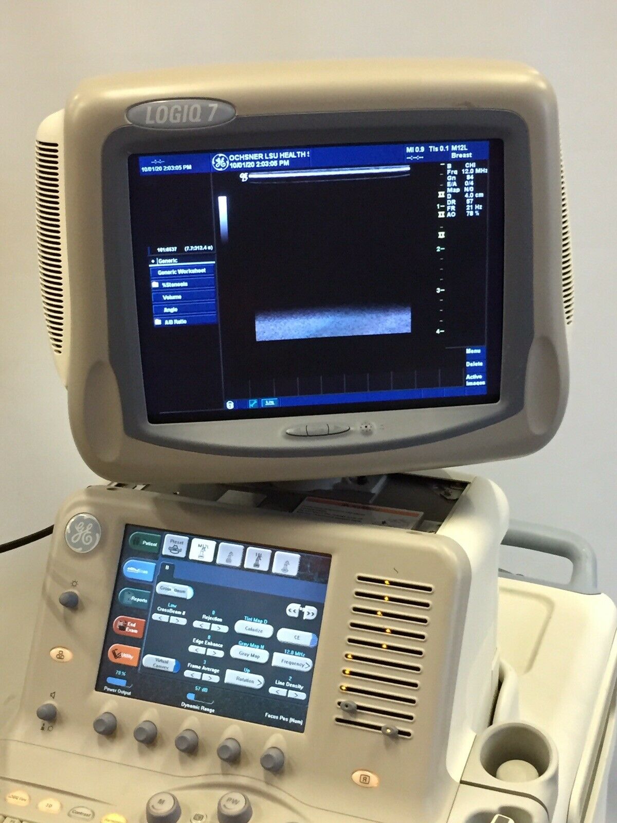 GE LOGIQ 7 Ultrasound Machine W/ 2 Probes (M12L, 10L) 2389220 DIAGNOSTIC ULTRASOUND MACHINES FOR SALE