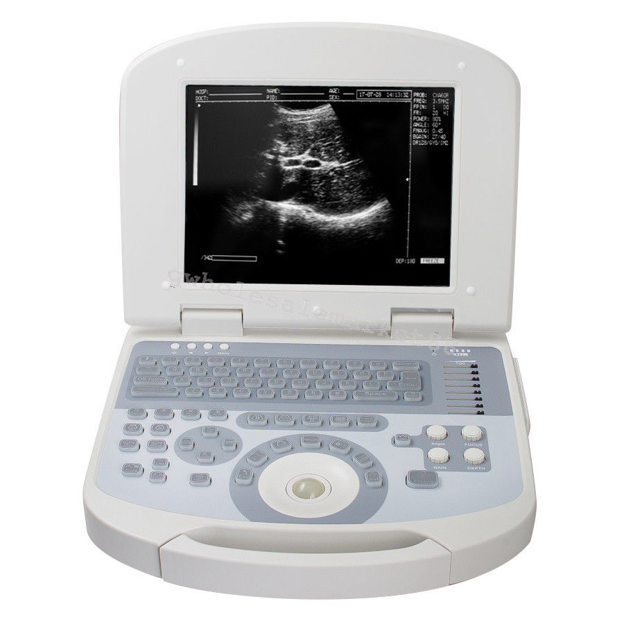 Portable Laptop Ultrasound Machine Scanner Convex Probe 3D Software Image 190891045898 DIAGNOSTIC ULTRASOUND MACHINES FOR SALE