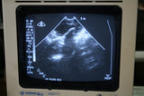 ATL Ultrasound Probes Curved Linear Array IVT 5.0 MHz