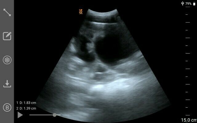 MX5 Go Portable Ultrasound The World’S First App-Based Swine Ultrasound DIAGNOSTIC ULTRASOUND MACHINES FOR SALE