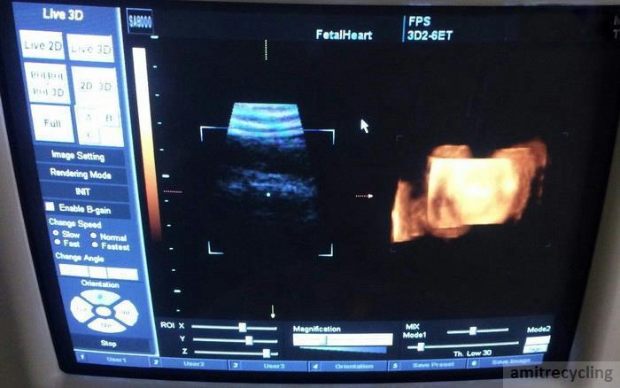 Medison 3D 2-6ET 3D/4/D Convex Probe SonoAce 9900, 8000 Samsung DIAGNOSTIC ULTRASOUND MACHINES FOR SALE