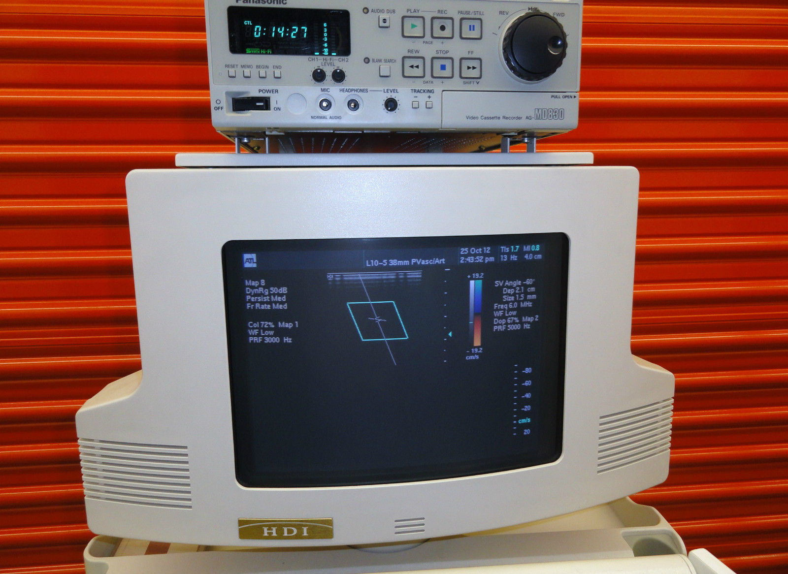 ATL HDI-3000 ULTRASOUND W/ L7-4 & L10-5 VASCUALR-SMALL PARTS PROBES PRINTER &VCR DIAGNOSTIC ULTRASOUND MACHINES FOR SALE