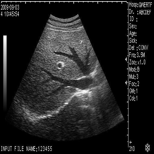 Full Digital Laptop Ultrasound Scanner Probe 6.0mhz Transvaginal Probe 3D Kit 190891462466 DIAGNOSTIC ULTRASOUND MACHINES FOR SALE