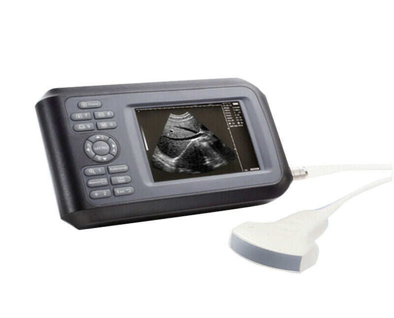 5.5'' Digital Ultrasound Scanner Machine With R40 3.5Mhz Convex Probe Human Use DIAGNOSTIC ULTRASOUND MACHINES FOR SALE