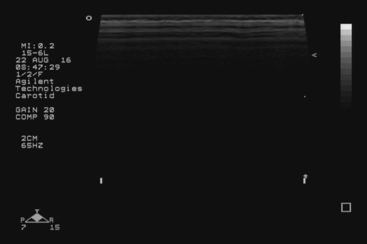 Philips 15-6L 21390A Ultrasound Probe - Final Sale Price! DIAGNOSTIC ULTRASOUND MACHINES FOR SALE