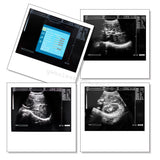 Laptop Ultrasound Machine Scanner Convex Probe 3D Software High Resolution Clear 190891045898