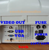 Portable Digital Ultrasound Scanner Machine & Linear probe 2 USB 3D Scan Update 190891561299