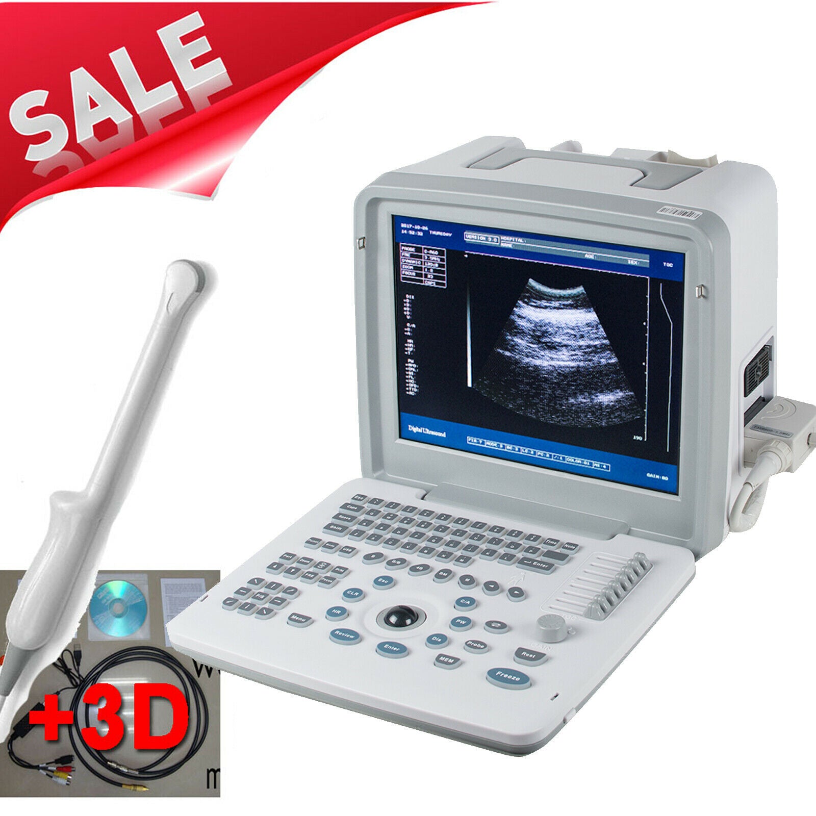 LCD Full Digital Portable Ultrasound Scanner Machine +7.5 Transvaginal Probe +3D DIAGNOSTIC ULTRASOUND MACHINES FOR SALE