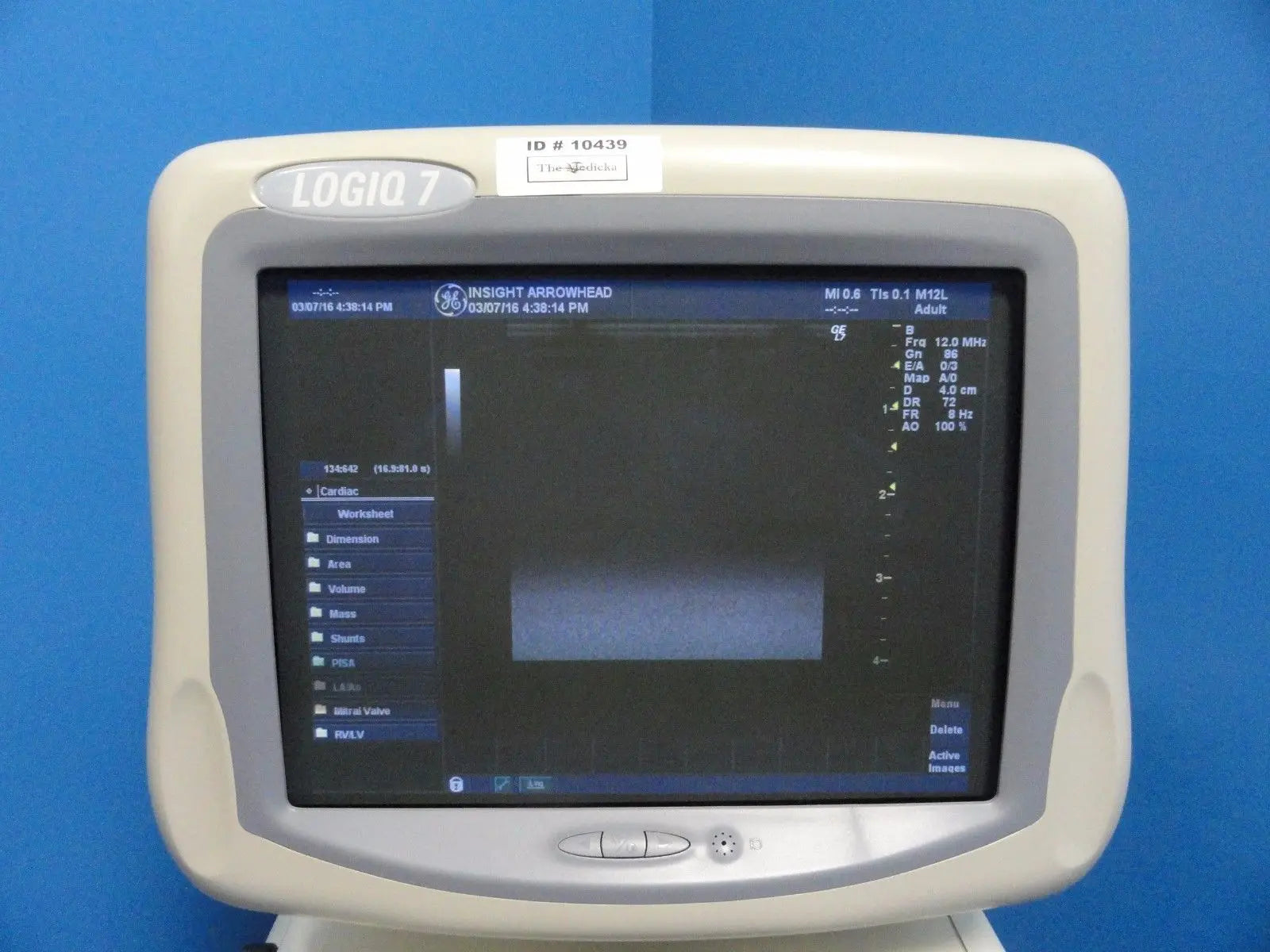 2004 GE Logiq 7 Ultrasound System W/ M12L, 3.5C Probes & B/W Printer (10439) DIAGNOSTIC ULTRASOUND MACHINES FOR SALE