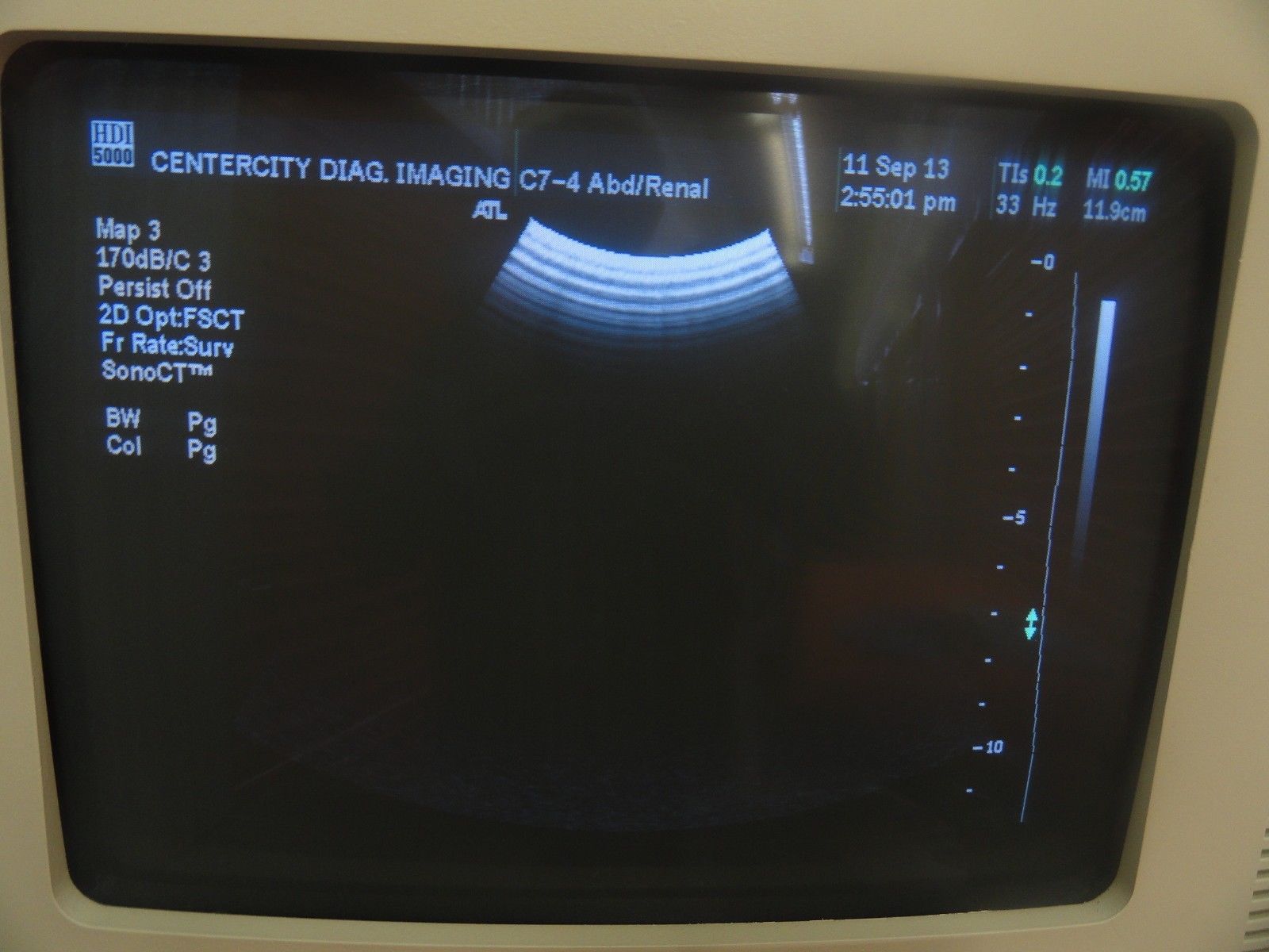 ATL C7-4 40R Curved Array Probe For ATL UM9 HDI, HDI 1500/ 3000 HDI 5000 (5840 ) DIAGNOSTIC ULTRASOUND MACHINES FOR SALE