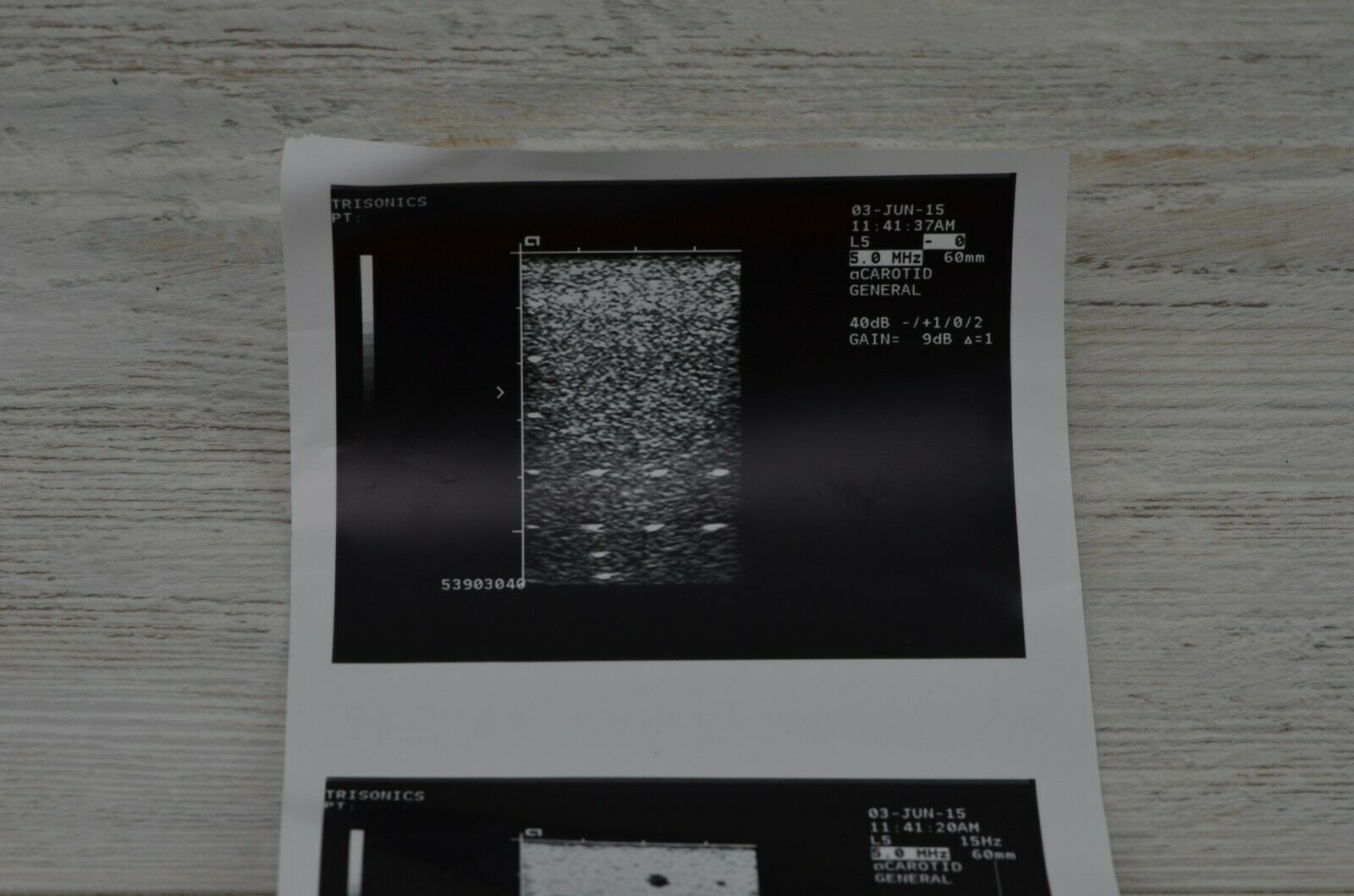 Acuson 5 Needle Guide L5 Model No. 08245443 Ultrasound Probe DIAGNOSTIC ULTRASOUND MACHINES FOR SALE