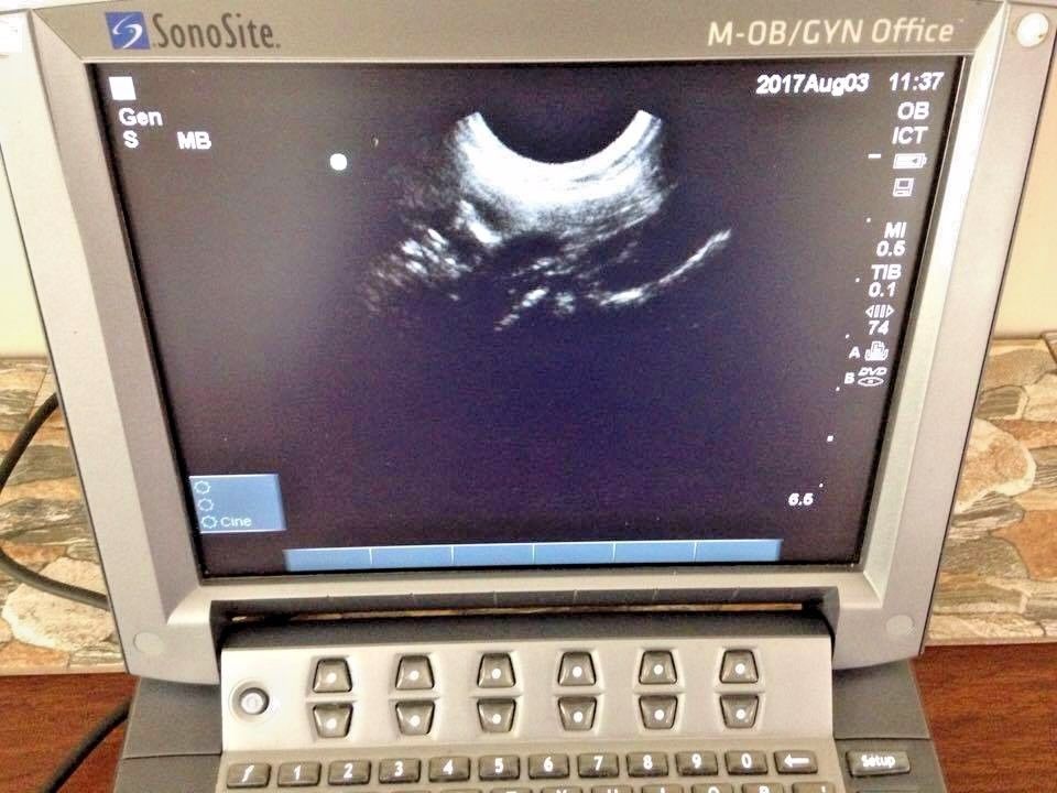 SonoSite M-Turbo Portable Ultrasound System OB/GYN: BOX ONLY DIAGNOSTIC ULTRASOUND MACHINES FOR SALE